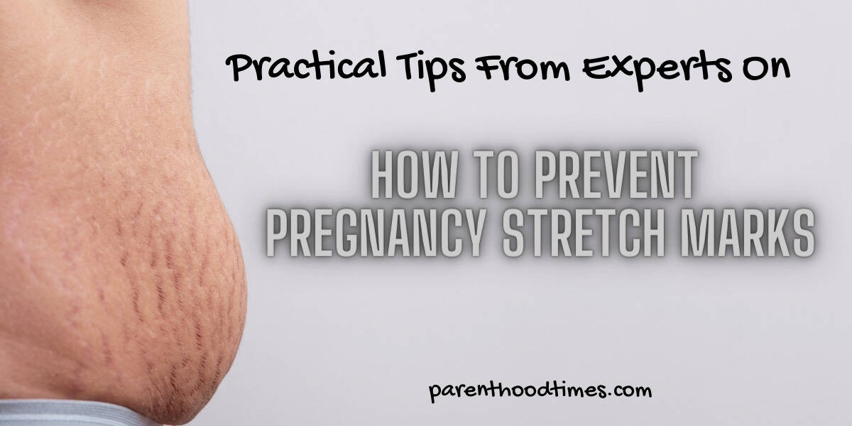 How to Prevent Pregnancy Stretch Marks
