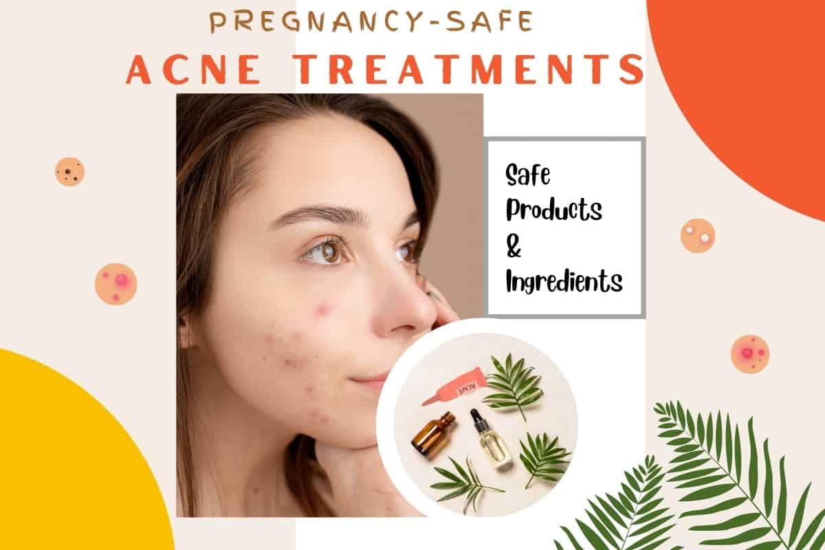 Safe Products for Pregnancy Acne Treatments